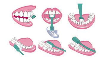  中华口腔医学会发布--标准刷牙方法 