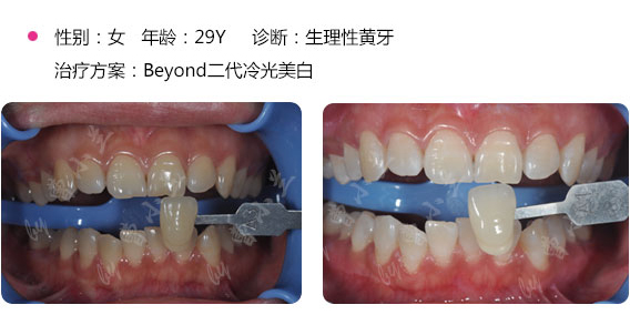 爱康健医师曹小兰医生案例