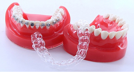 深圳透明陶瓷牙套多少钱_爱康健齿科集团