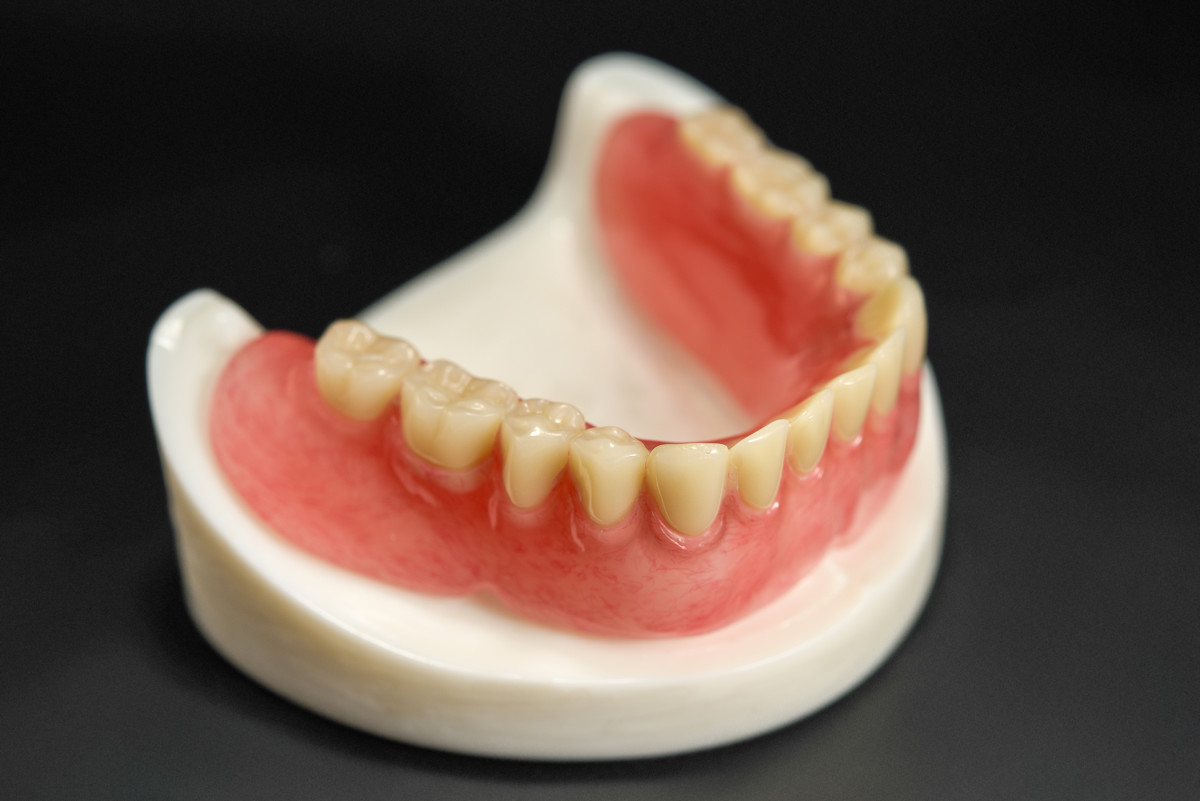 牙齿龋坏/桩核冠修复 - 知乎