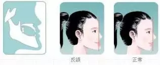 怎么孩子越长越丑?怪牙咯!