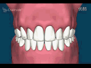13种已被证实的牙周病诱发症，为什么老烟民更容易惹上？