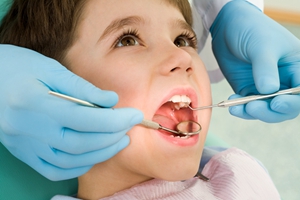 孩子乳牙蛀牙应该拔除吗？
