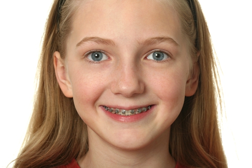 孩子牙齿不齐到底是哪些原因？