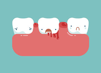 牙周炎危害大吗？牙周炎要怎么治疗？