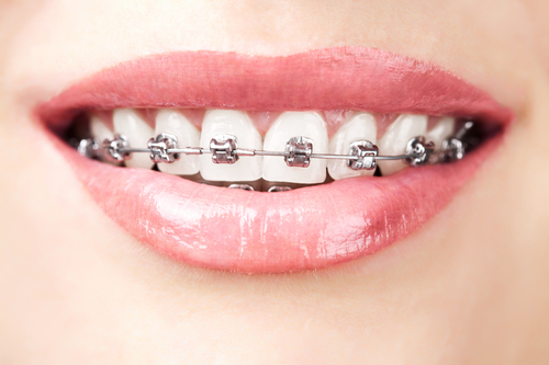 牙齿畸形不齐会带来什么危害？