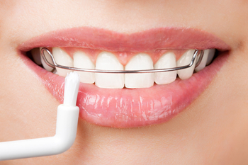 牙齿矫正为什么会反弹？