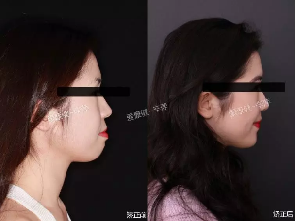 【親愛的熱愛的】總有一些檸檬精,看別人變好看都覺得是整容!