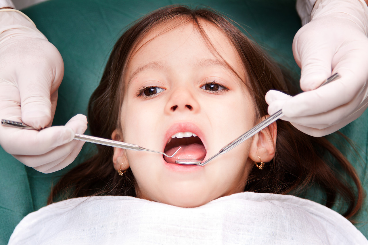 儿童矫正牙齿需要多少钱