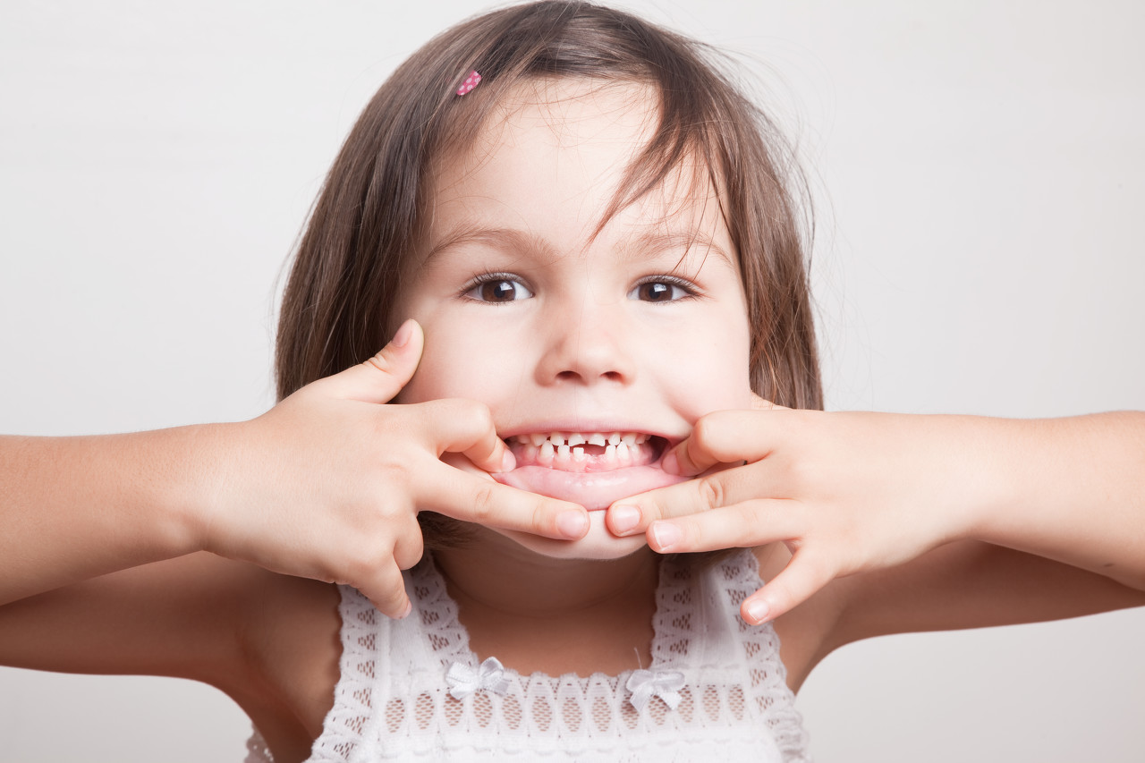 儿童牙齿咬合错位图,孩子牙齿错位图片,儿童门牙换牙畸形图片(第8页)_大山谷图库