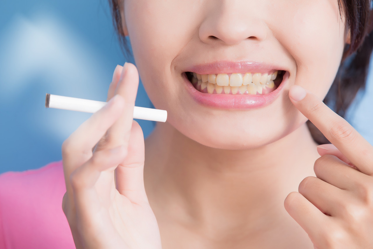 Methods of teeth whitening for smokers | tidatabase.org
