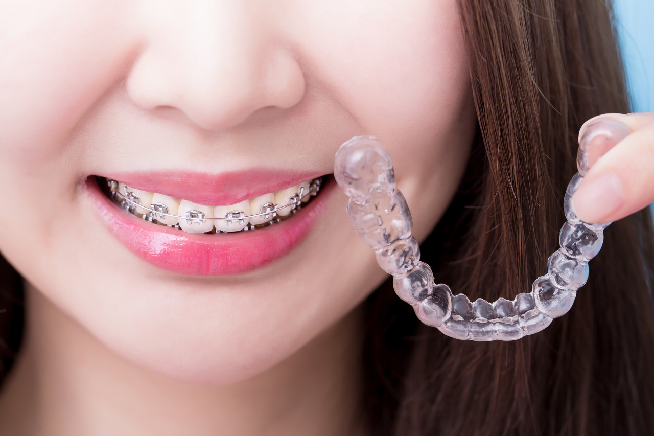 有牙周病可以进行牙齿矫正吗？深圳哪家医院做牙齿矫正比较好？