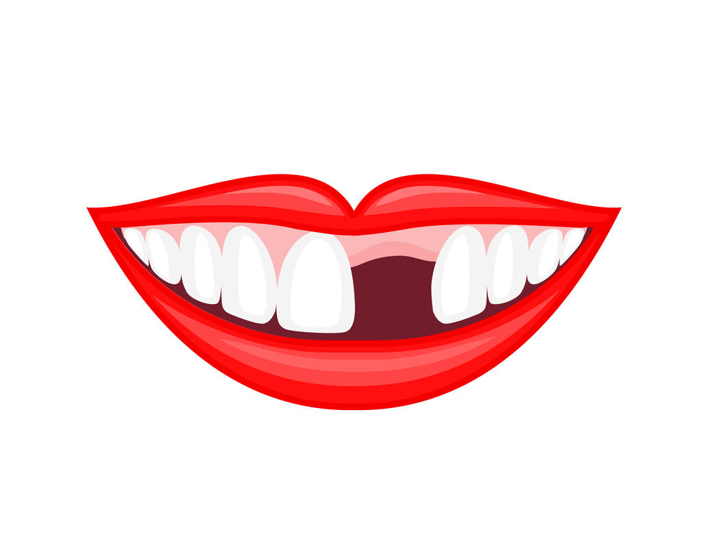 牙齿缺失有哪些危害？牙齿缺失怎么修复？