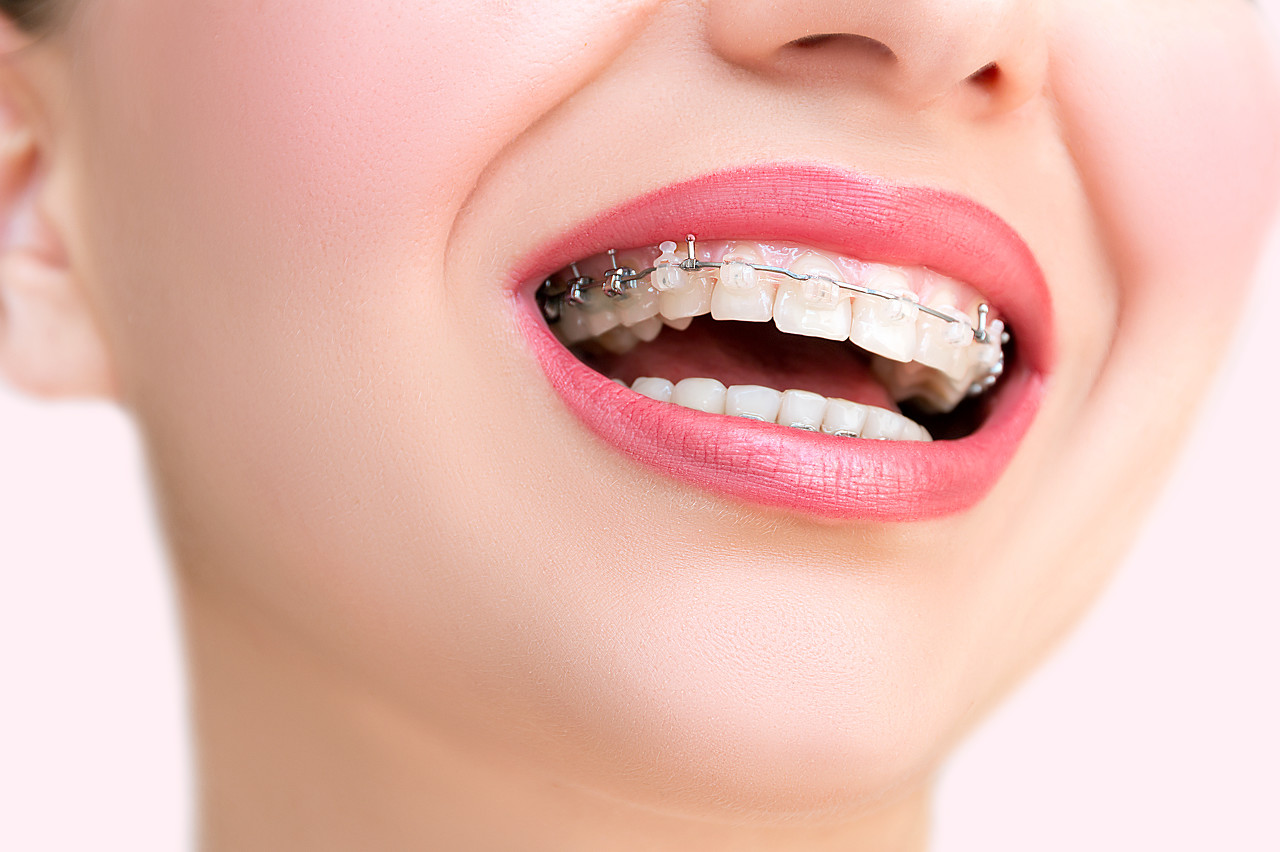 为什么牙齿矫正一定要面诊？牙齿矫正面诊步骤是怎样的？