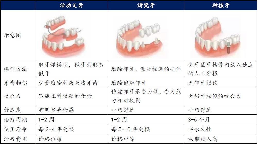 义齿、镶牙和种植牙对比示意图