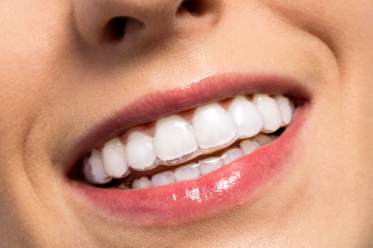 超声波洁牙和洗牙有什么区别