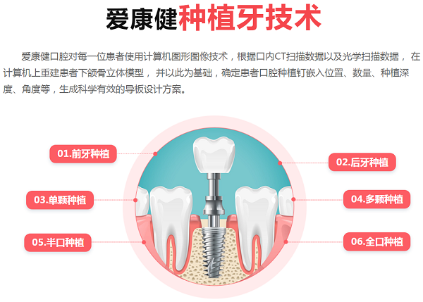 深圳种植牙医院