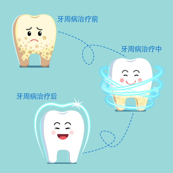 深圳深度清潔牙齒多少錢