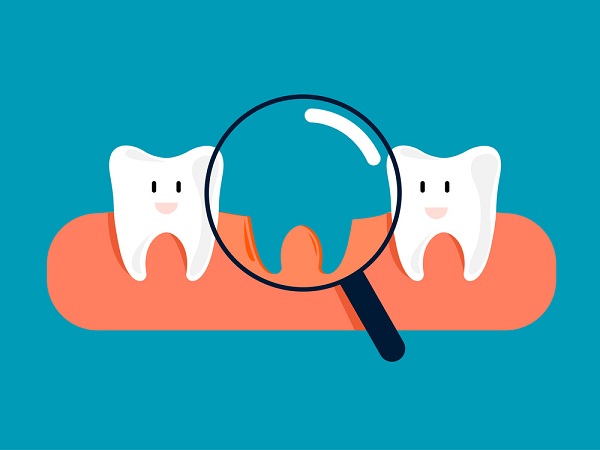 夜晚磨牙種牙會有影響嗎