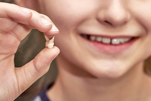 拔牙是否影响脸型