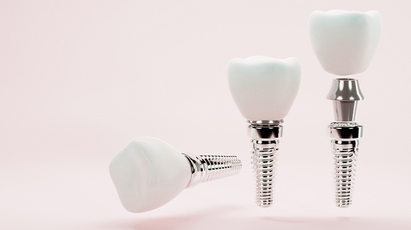 深圳瑞士ITI種植牙多少錢一顆