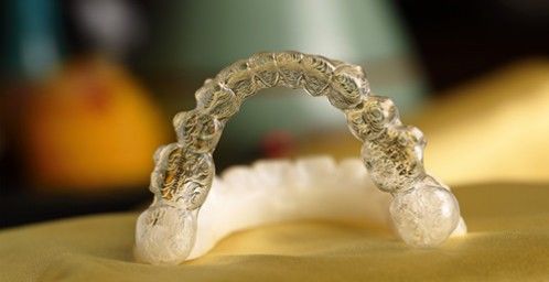 成人隐形牙齿矫正贵吗