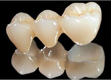 烤瓷牙套在医保范围吗 烤瓷牙套医保