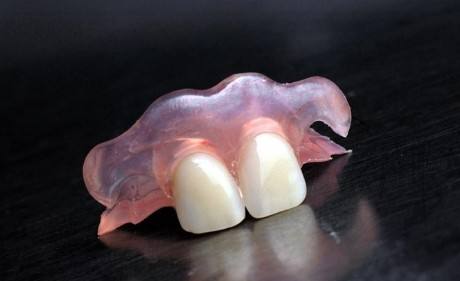 胶的活动假牙可以用多久